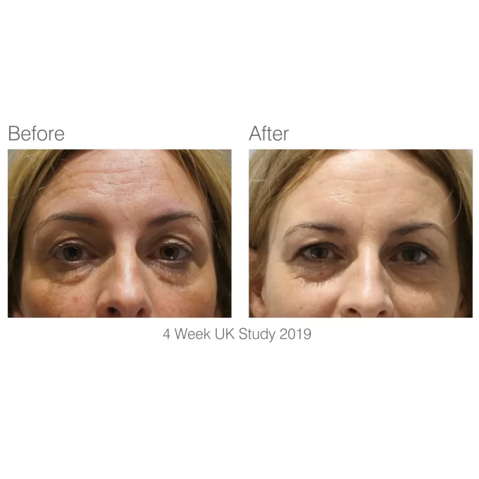 RIO Facelite Evolution - LED maska na obličej